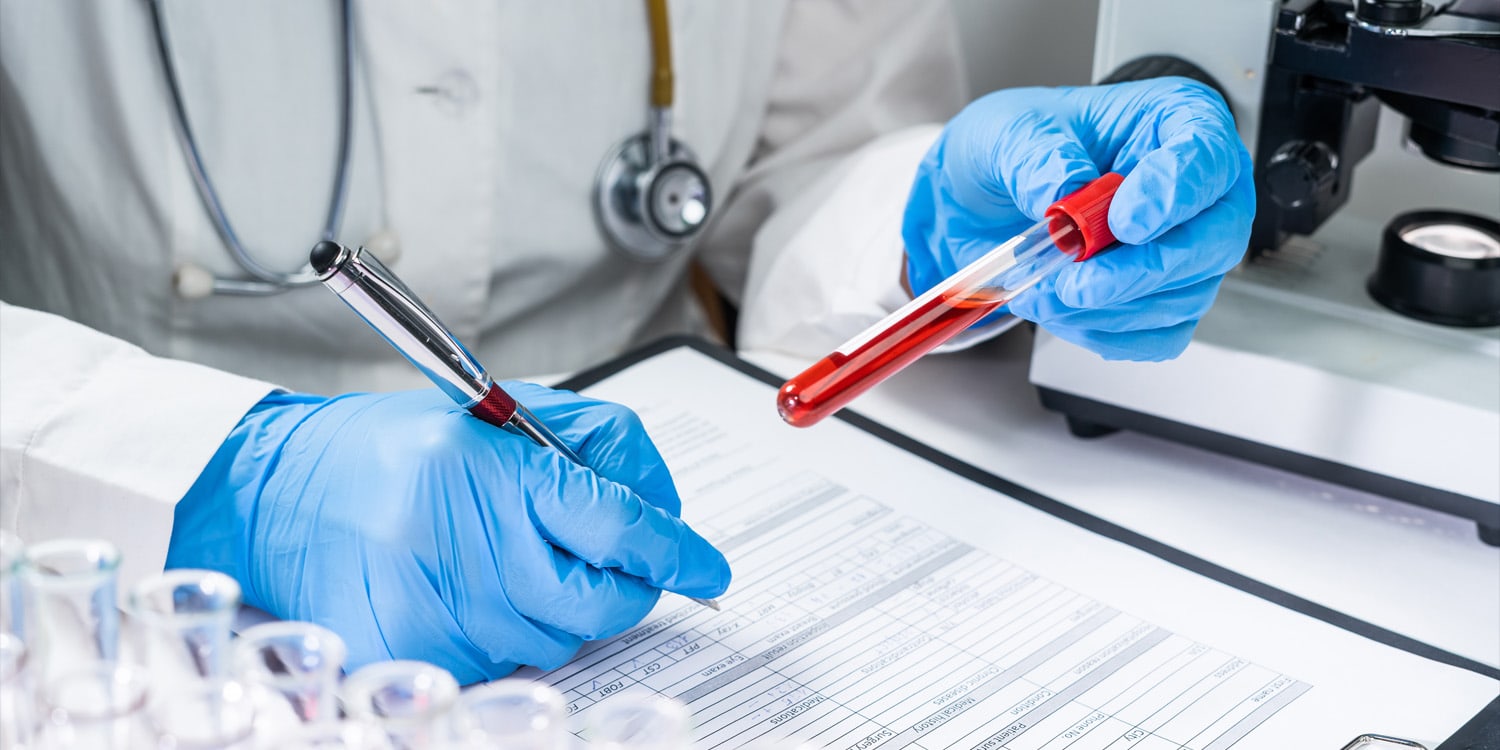 Biological sex influences how blood markers reflect Alzheimer’s severity