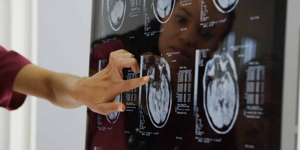 The surprising reason why cancer patients may be less likely to get Alzheimer’s
