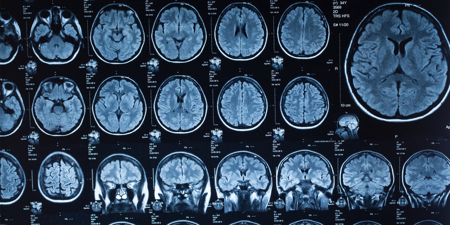 Cientistas identificam cinco fases distintas na estrutura cerebral ao longo da vida humana